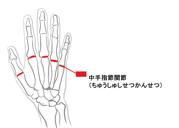 在本文中,掌指关节是关键点